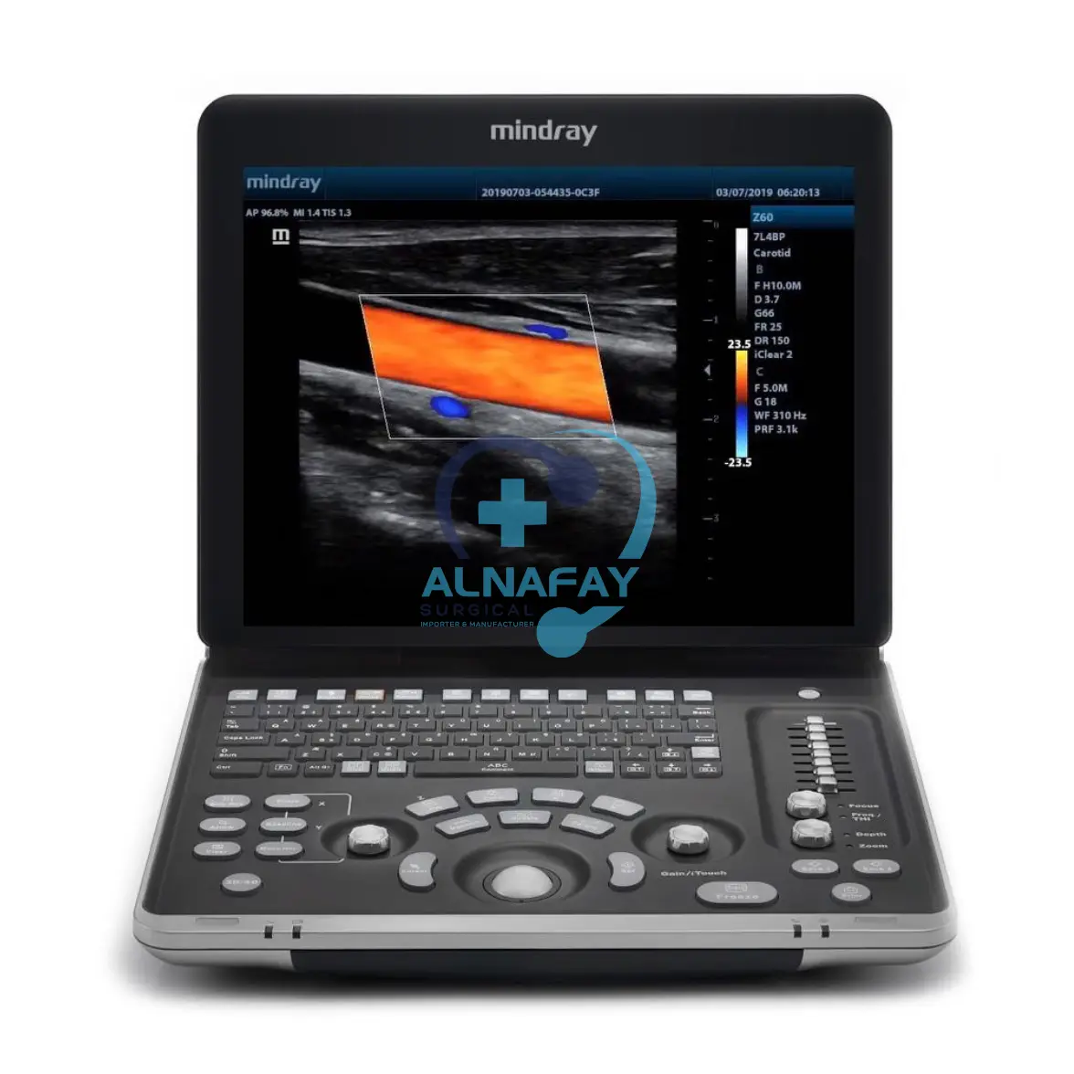 Mindray Z60 Ultrasound Machine