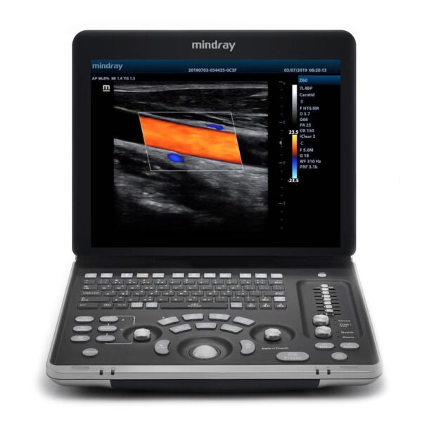Mindray Z60 ultrasound machine front view